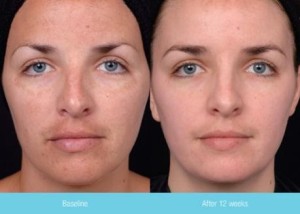 Condition Enhance System | Dr. Lisa Bunin | Allentown PA
