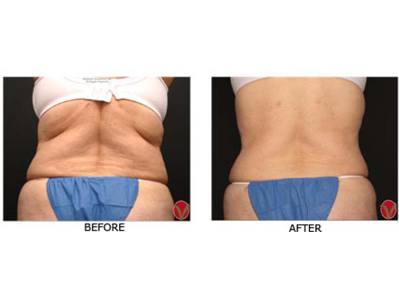 Vitamax garcinia cambogia ingredients picture 6