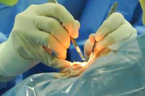 Dr. performing eyelid surgery | Blepharoplasty | Dr. Lisa Bunin | Allentown PA