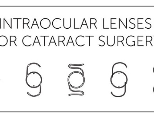 Cataract Lens Types for Cataract Surgery
