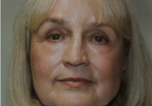 Laser Resurfacing Patient After| Before and After Photos | Dr. Lisa Bunin | Allentown PA