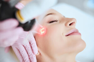 Laser treatments