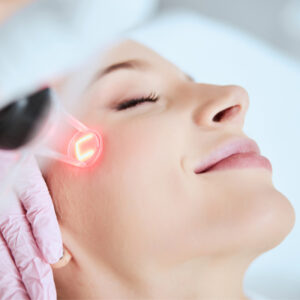 Laser skin treatment